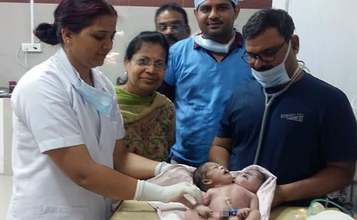 मध्य प्रदेश / विदिशा में महिला ने दो सिर, तीन हाथ और चार पंजे वाले बच्चे को दिया जन्म|