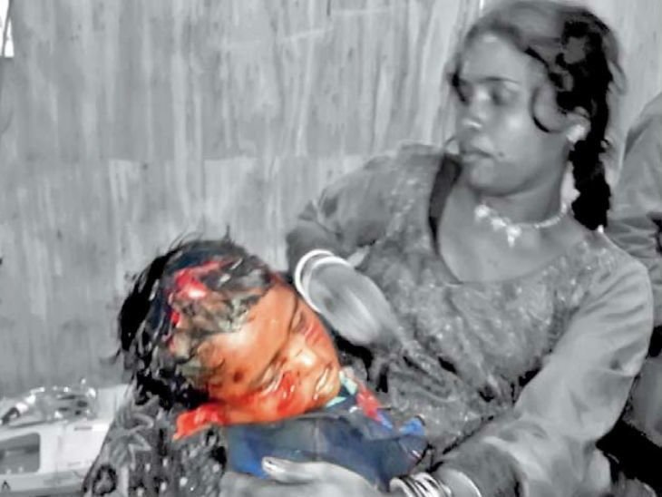 मां-बेटी चीखती रहीं, 4 साल के मासूम को 3 आवारा कुत्तों ने घर के बाहर नोच डाला